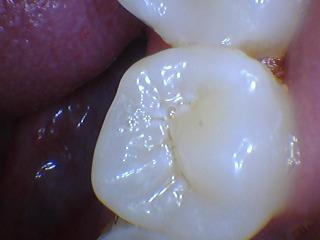 dentist glenmont ny | dentist delmar ny