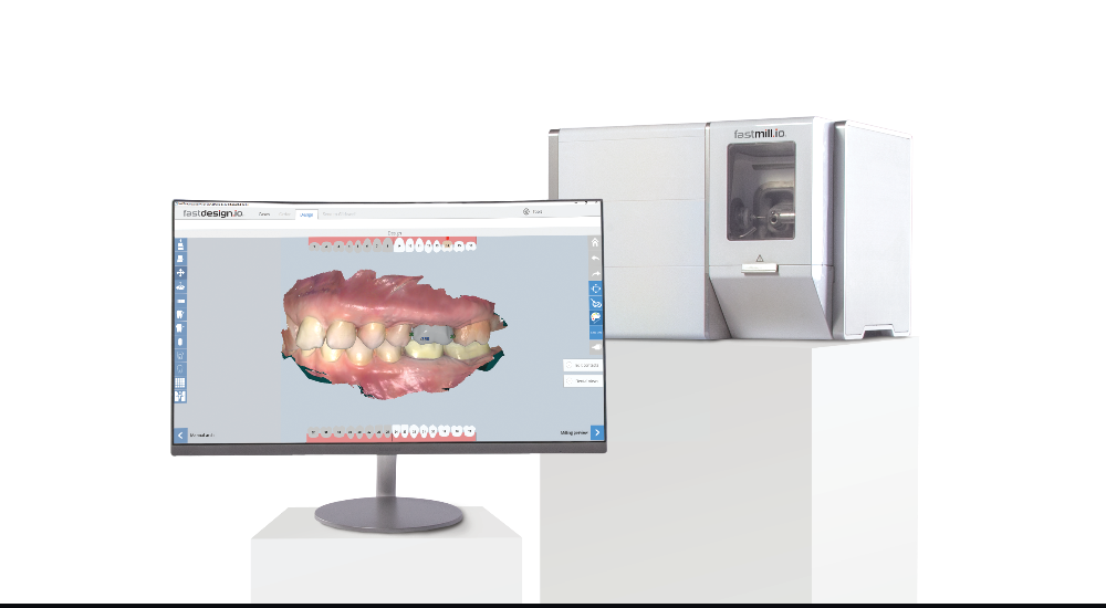 Glidewell Fastmill same day dental crowns in Glenmont NY